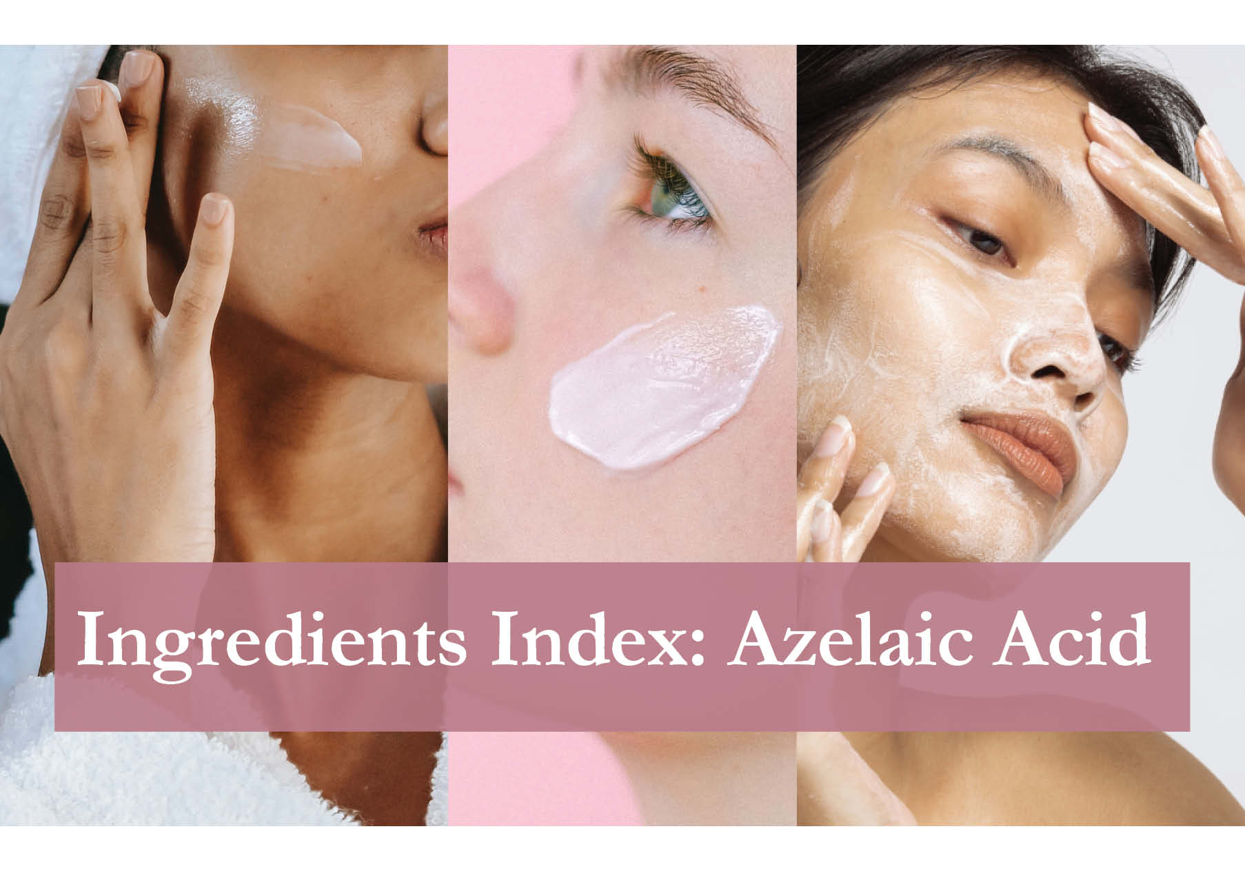 azelaic acid